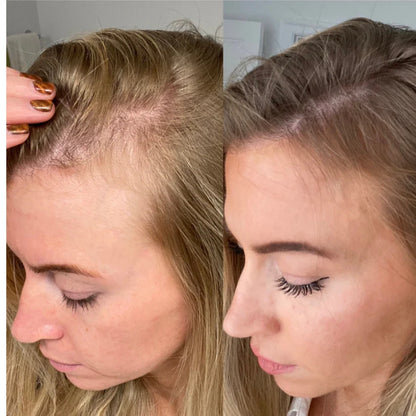 GrowTurn Hair Growth Serum 100ml