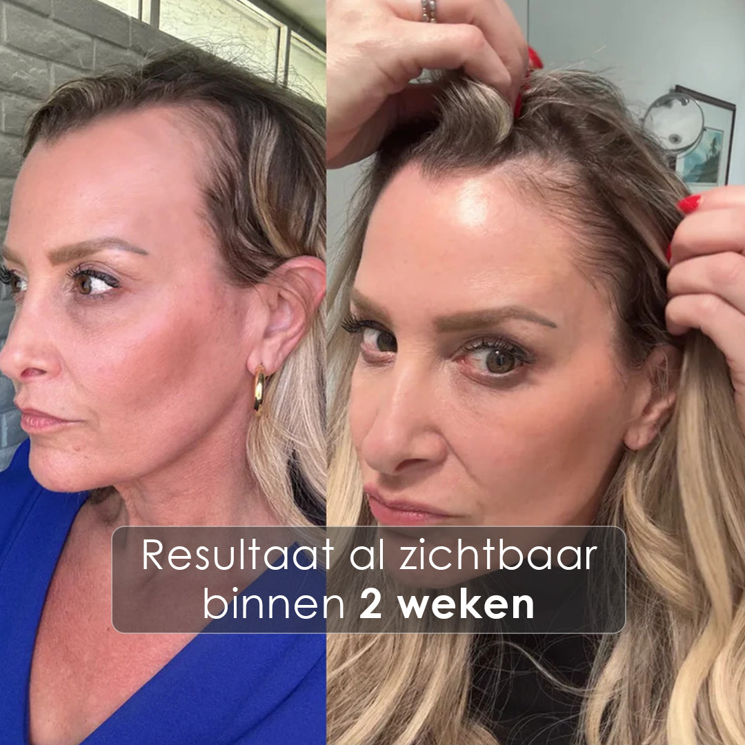 GrowTurn Hair Growth Serum 100ml